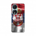 Futrola Silikonska Print Skin za Honor X7b SRB