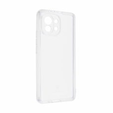Futrola Teracell Giulietta za Xiaomi Mi 11 transparent